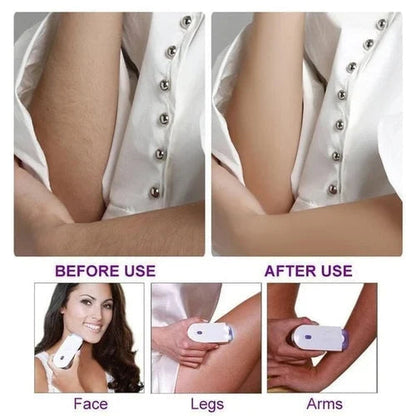 Rechargeable Instant & Painless Hair Remover with Sensa-Light – For Face & Body